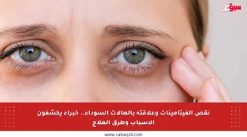 نقص الفيتامينات وعلاقته بالهالات السوداء.. خبراء يكشفون الأسباب وطرق العلاج